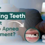 Missing Teeth Affect Sleep Apnea Treatment